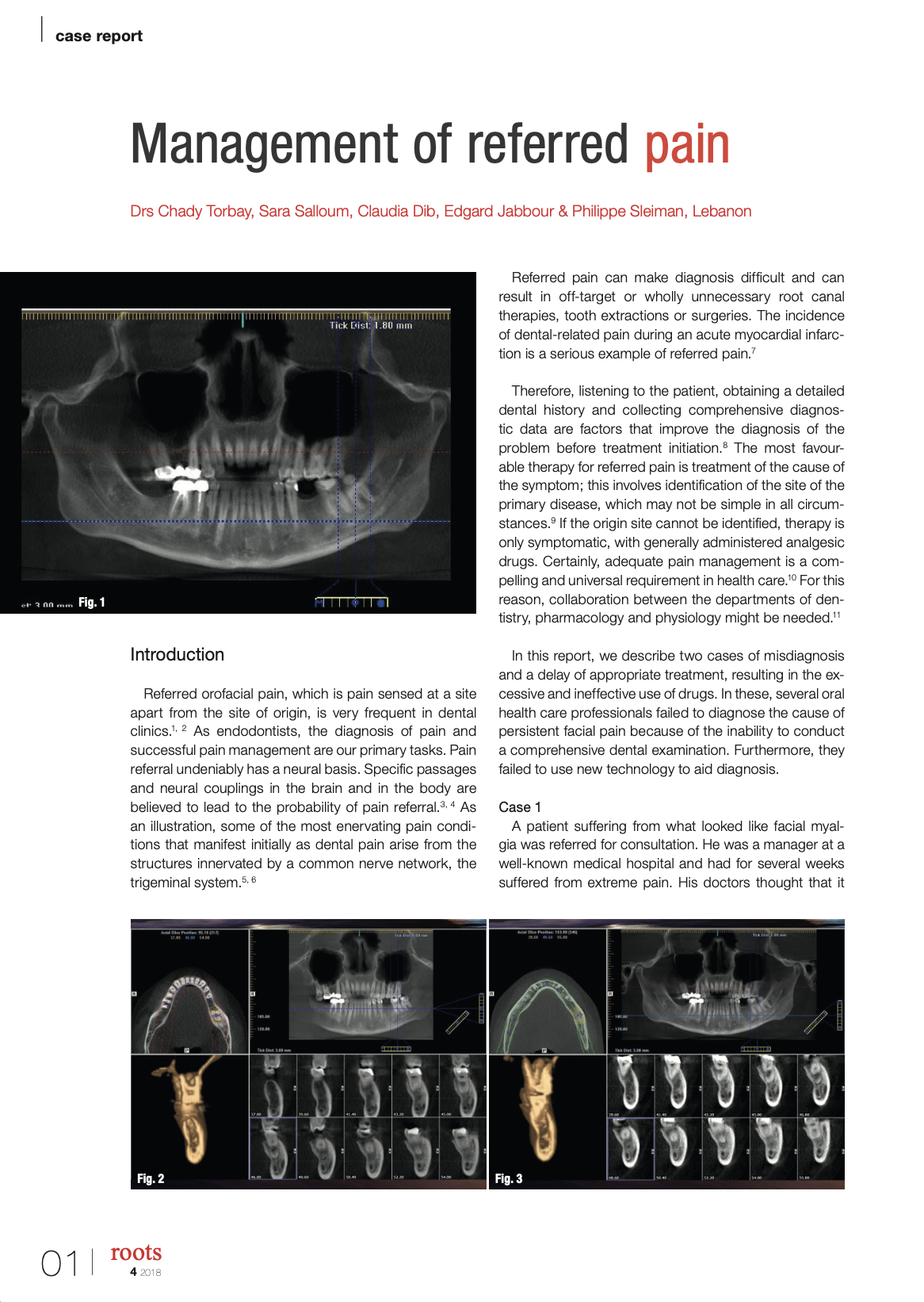 Management of referred pain