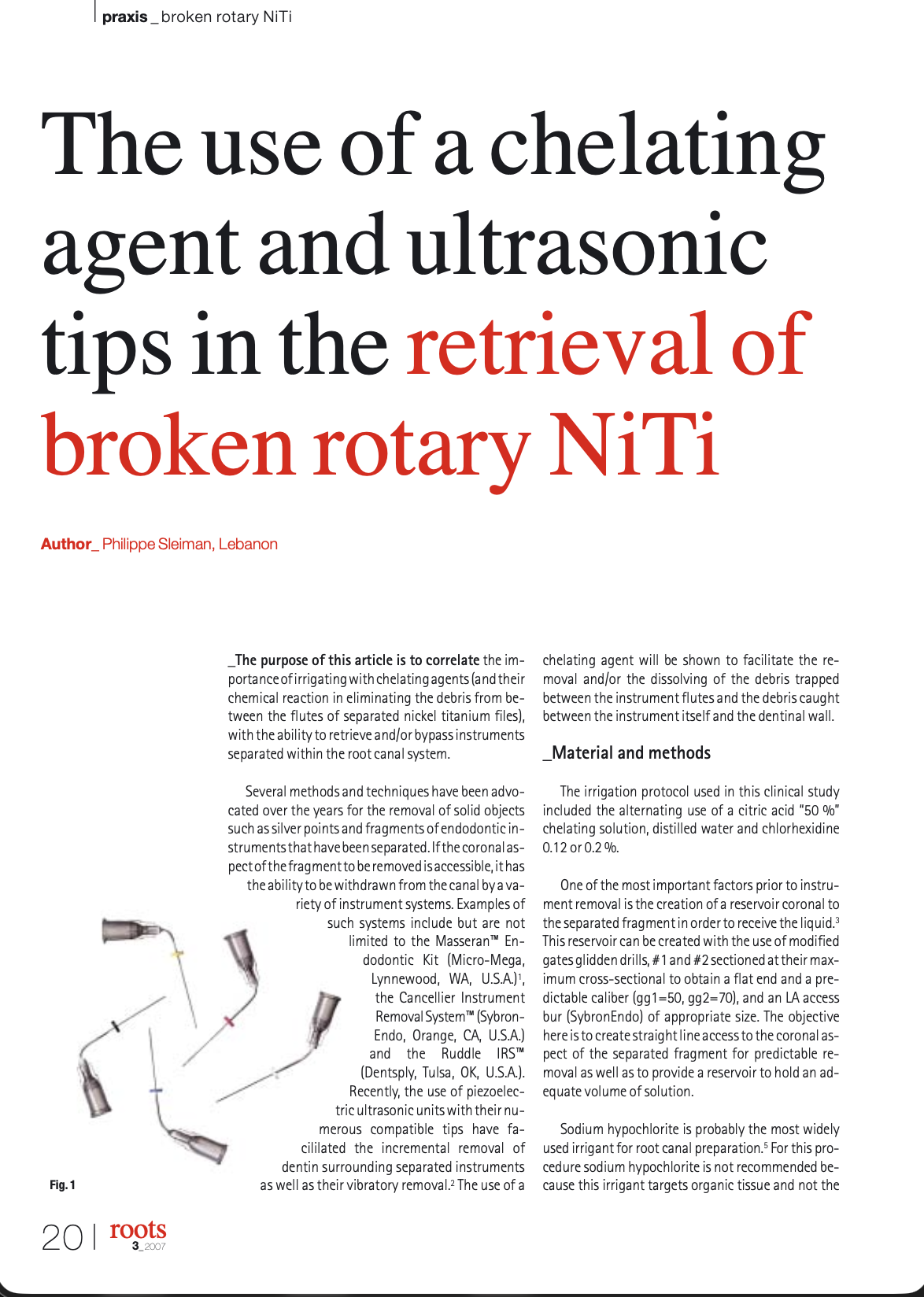 The use of a chelating agent and ultrasonic tips in the retrieval of broken rotary NiTi