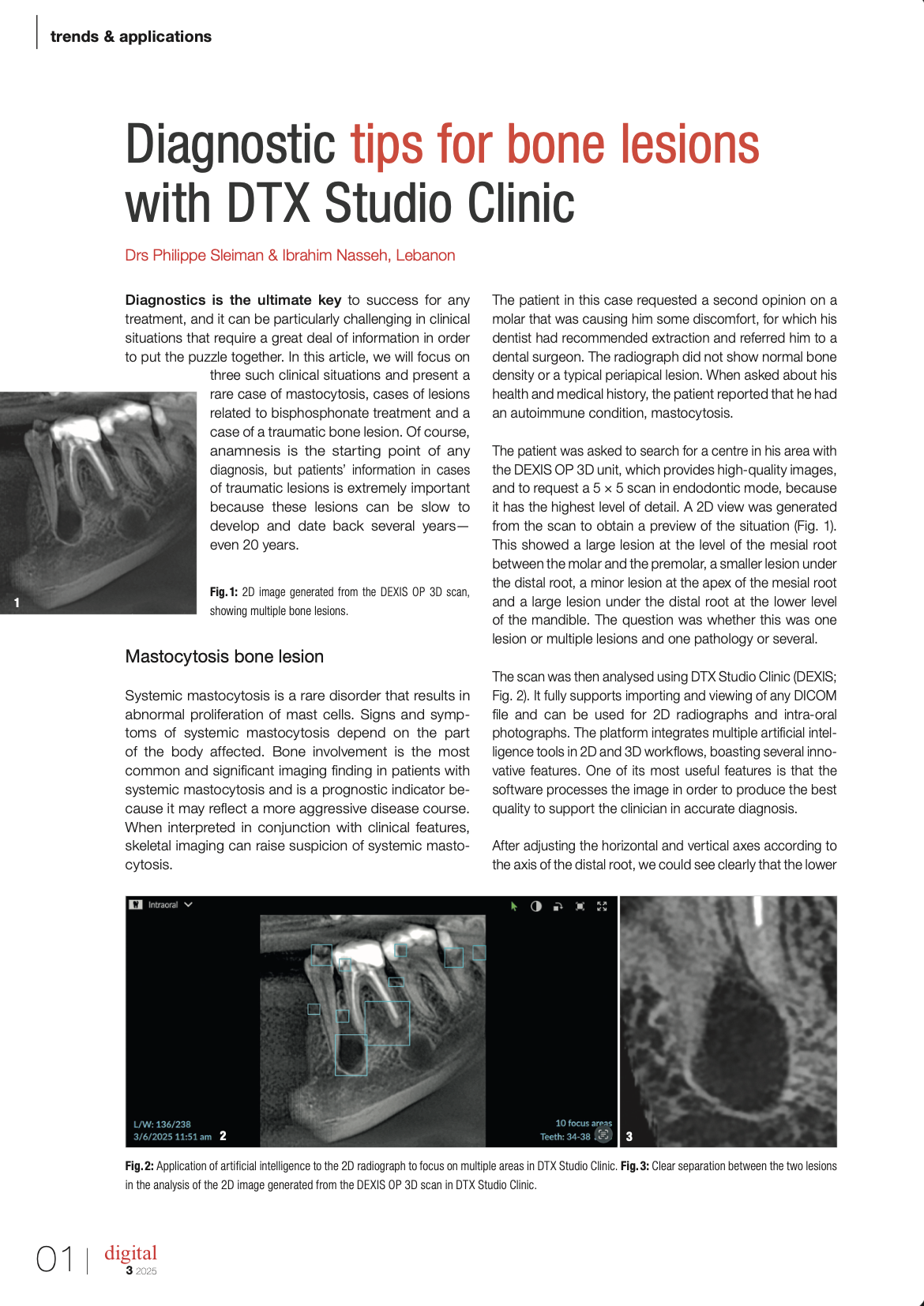 Diagnostic tips for bone lesions with DTX Studio