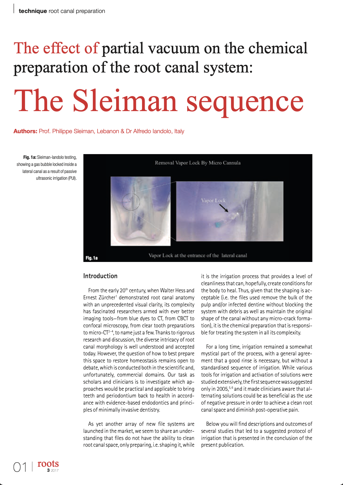 The effect of partial vacuum on the chemical preparation of the root canal system: The Sleiman sequence