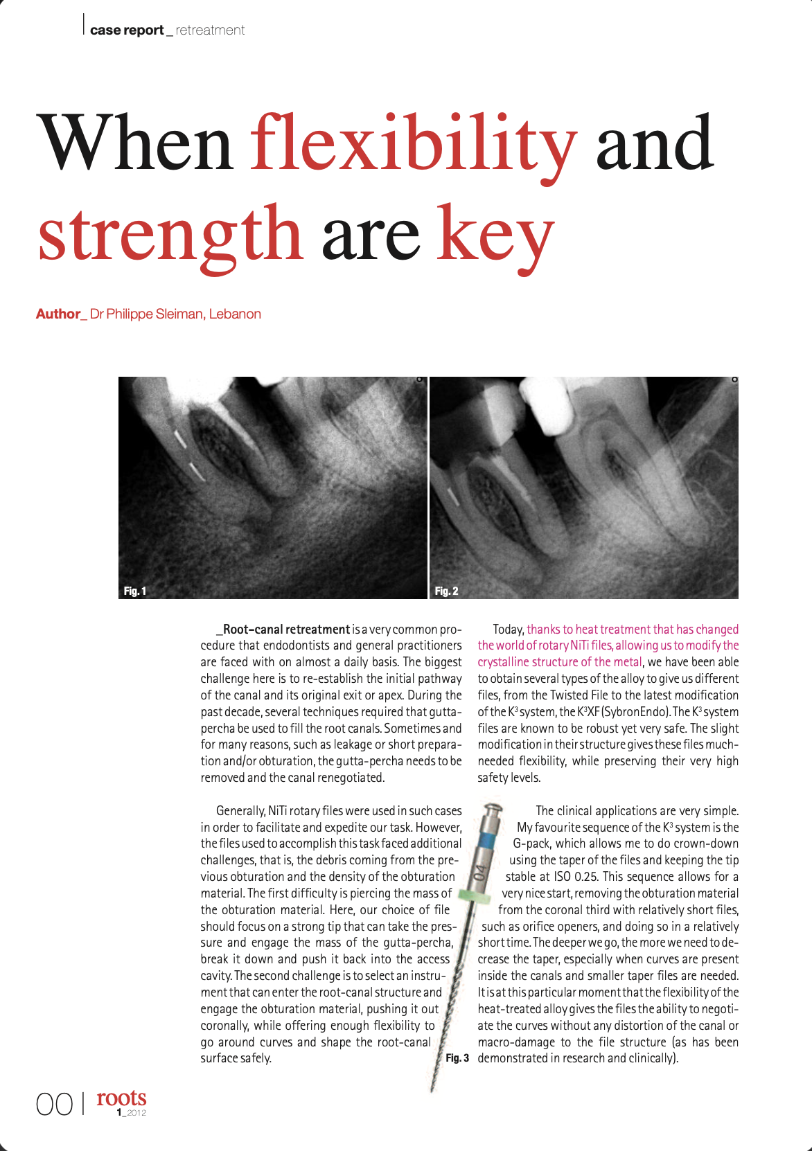 When flexibility and strength are key