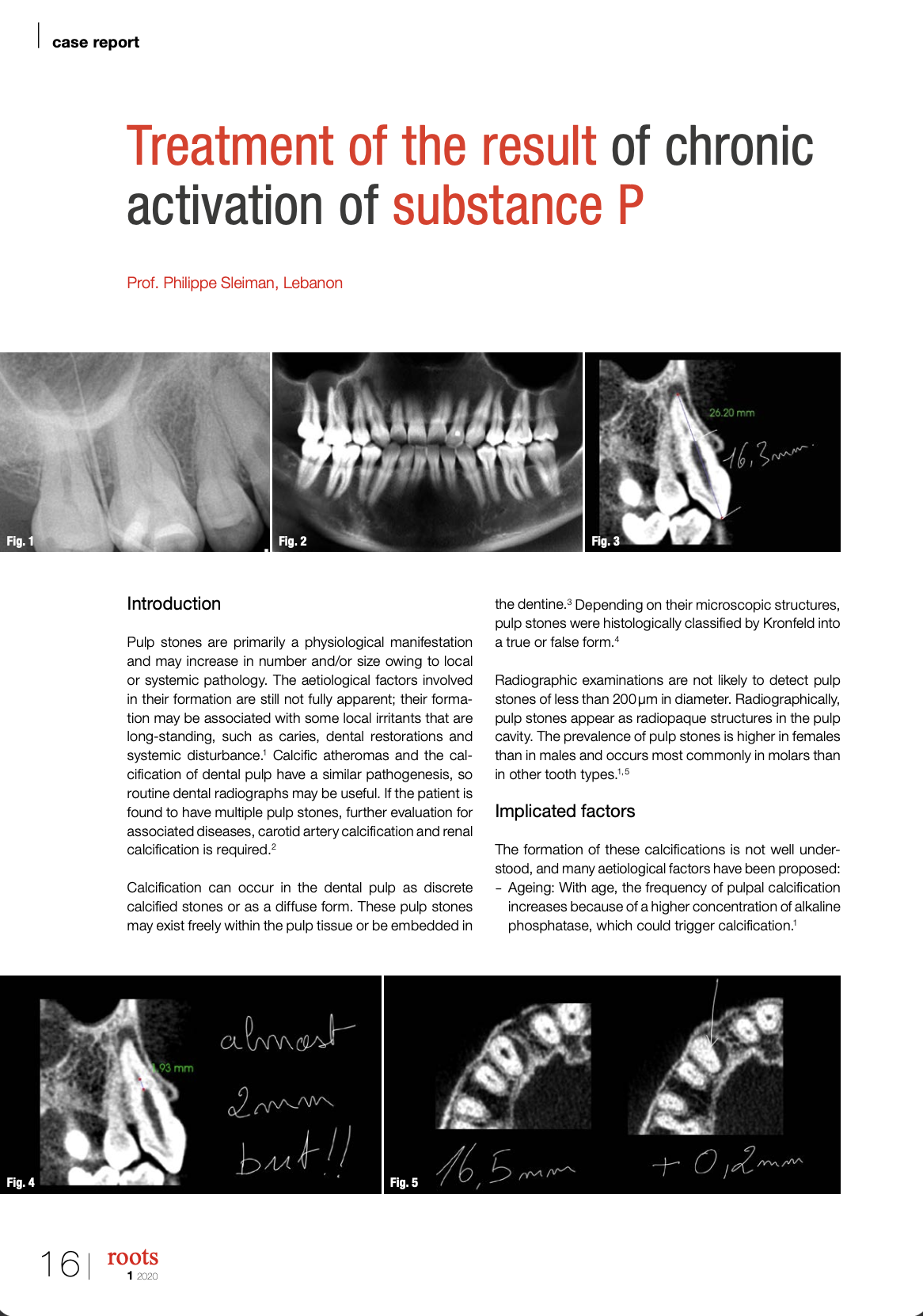 Treatment of the result of chronic activation of substance P