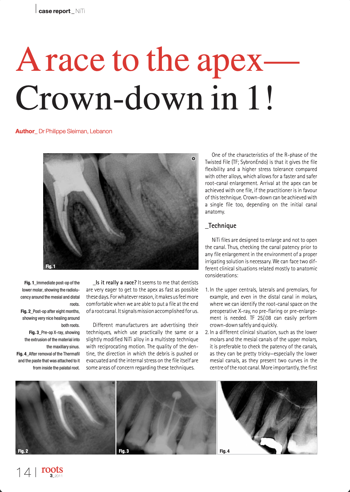 A race to the apex-Crown-down in 1!
