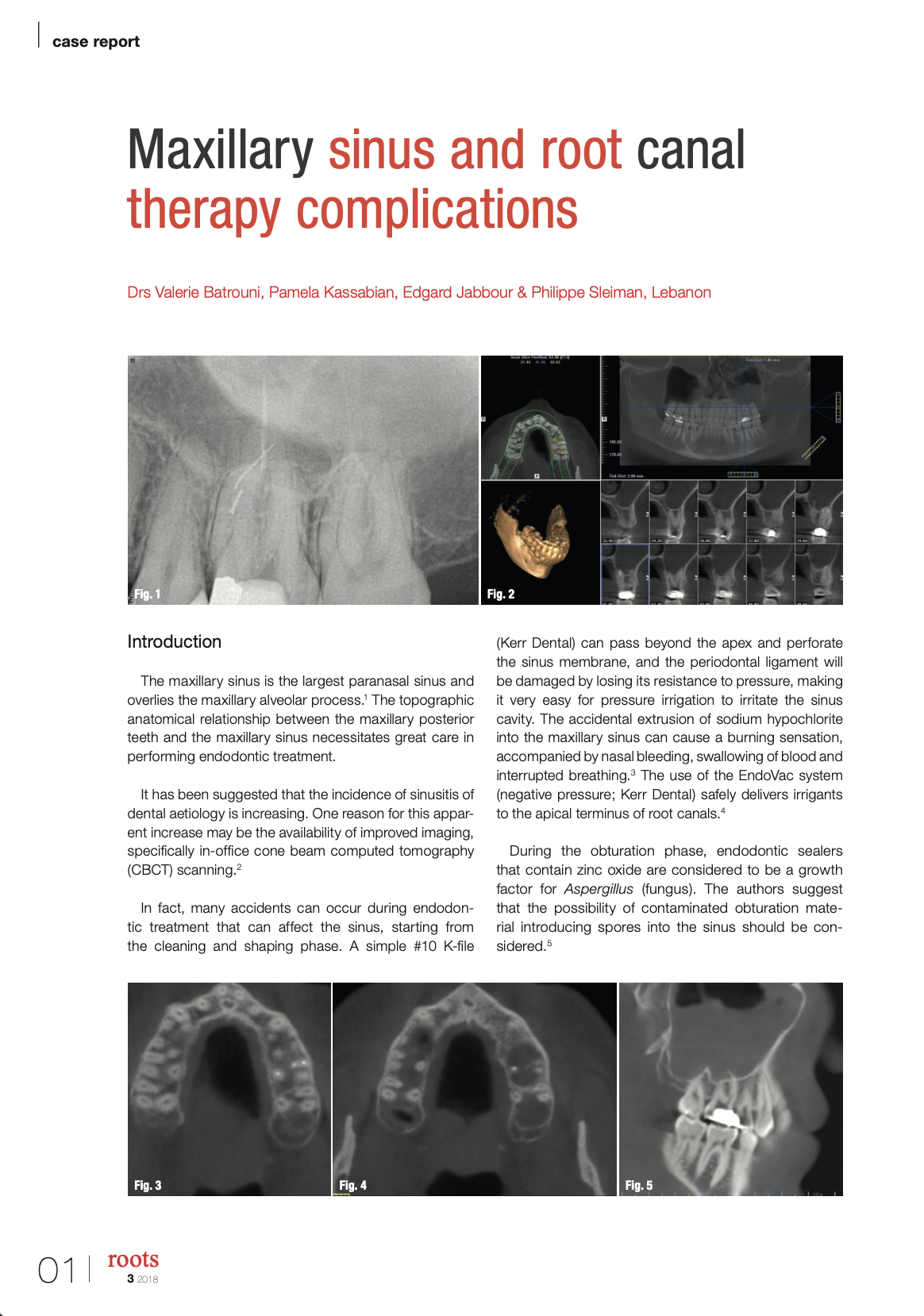 Maxillary sinus and root canal therapy complications