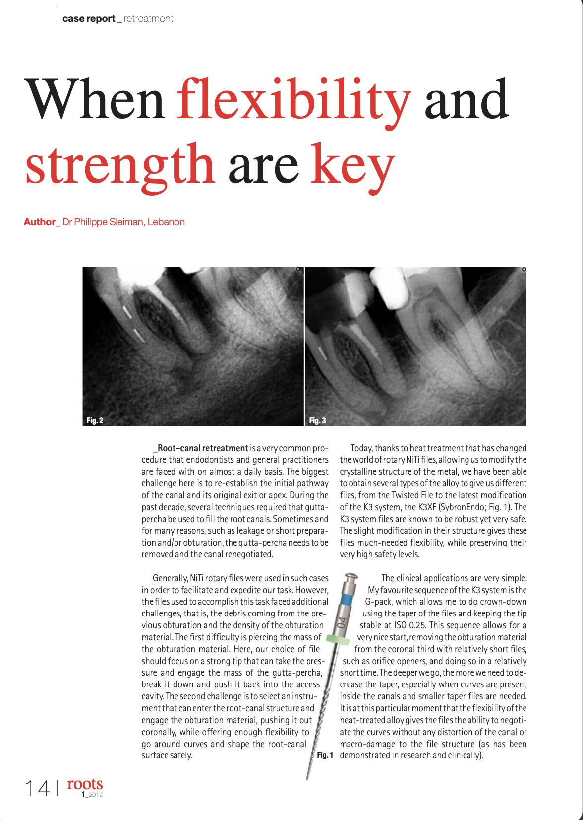 When flexibility and strength are key